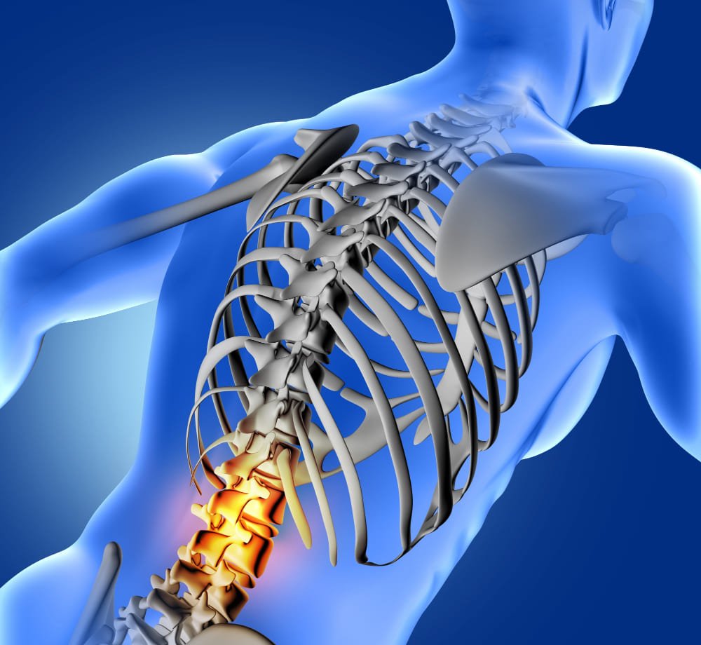 Todo sobre <strong>cirugía de columna lumbar en CDMX</strong>