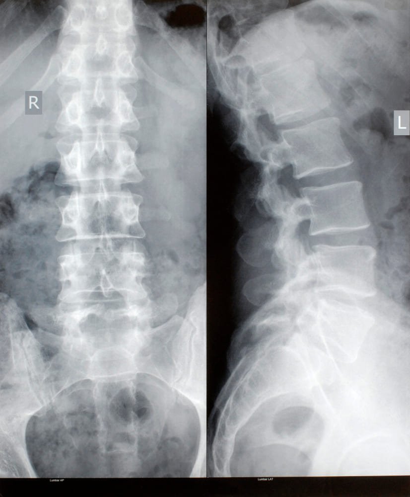 <strong>Tratamientos accesibles para columna en CDMX</strong>: cuida tu salud